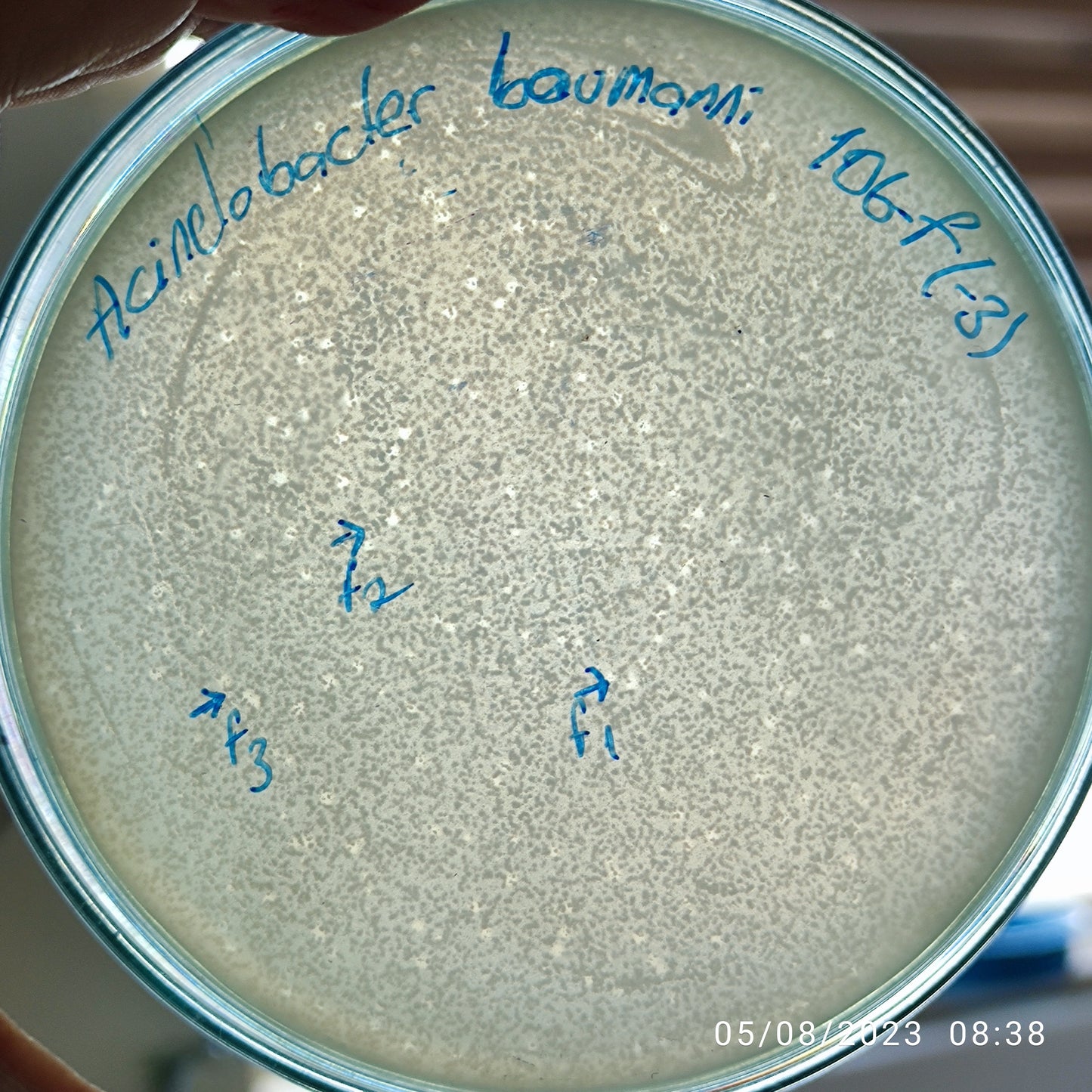 Acinetobacter baumannii bacteriophage 120106F