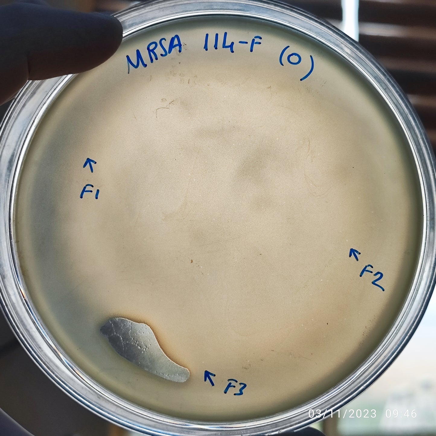 Staphylococcus aureus bacteriophage 150114F