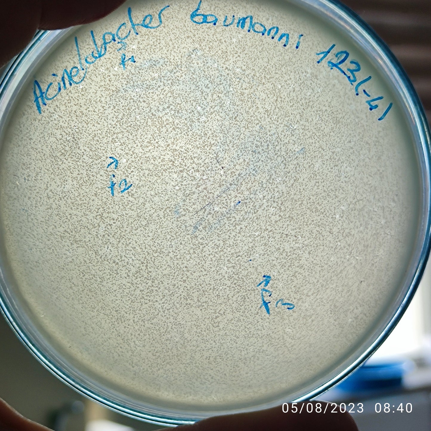 Acinetobacter baumannii bacteriophage 120123F