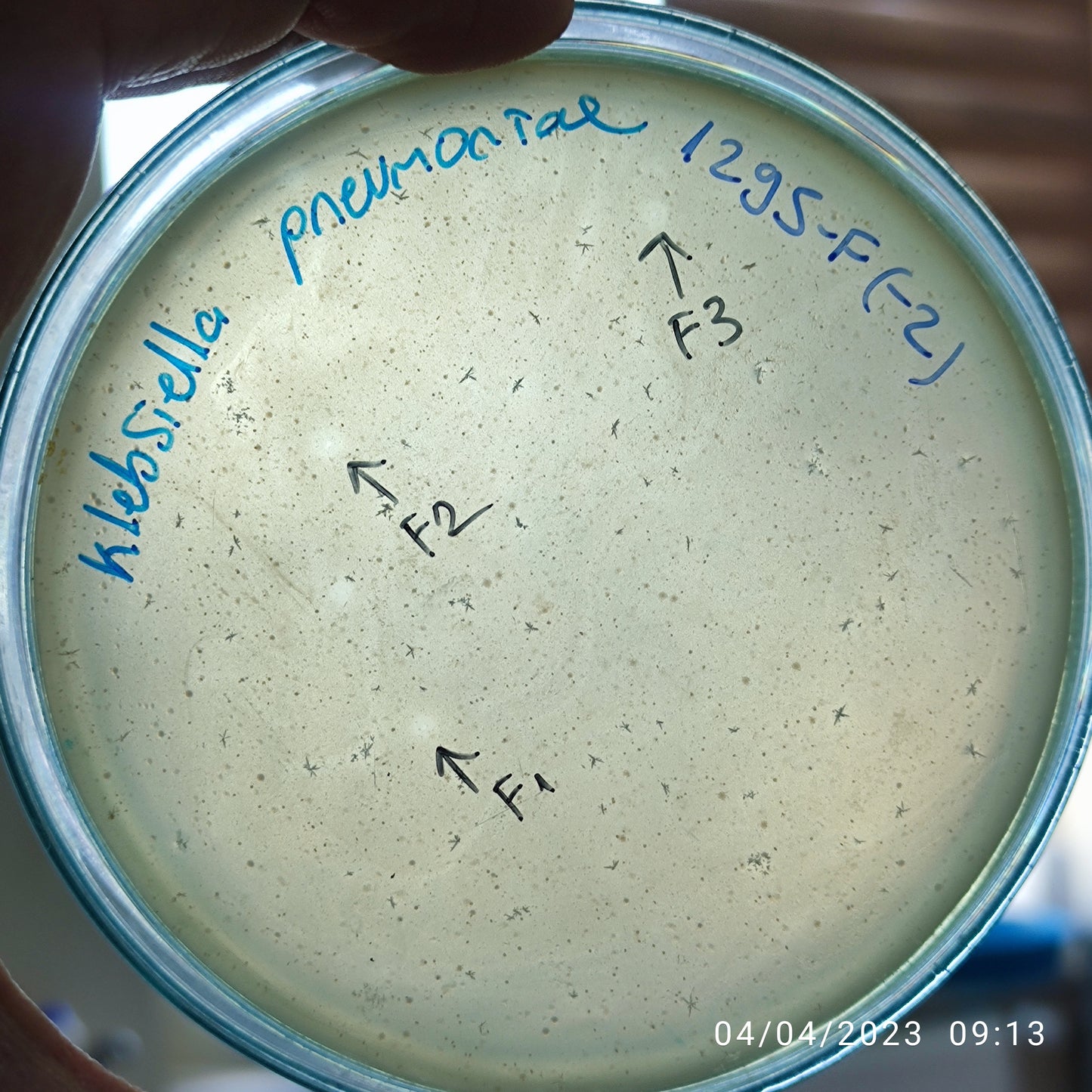 Klebsiella pneumoniae bacteriophage 181295F