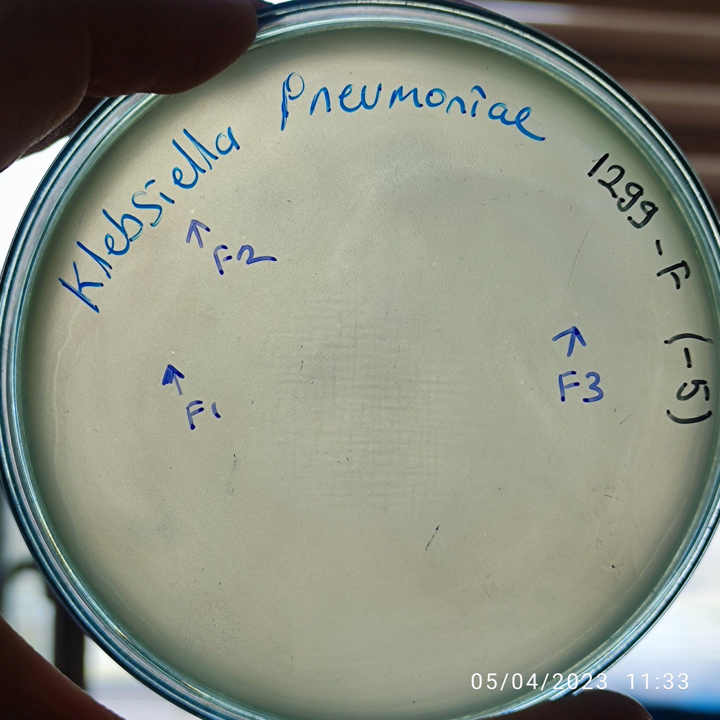 Klebsiella pneumoniae bacteriophage 181299F