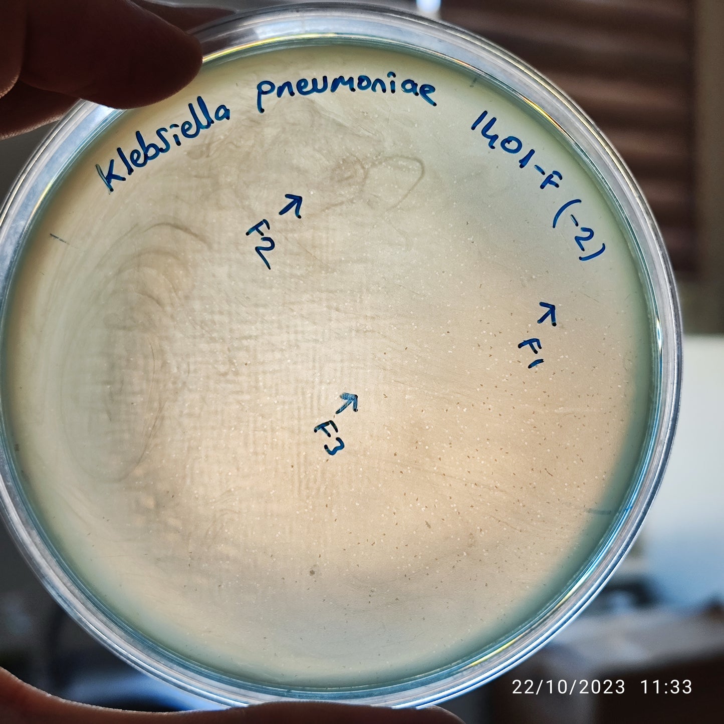 Klebsiella pneumoniae bacteriophage 181401F
