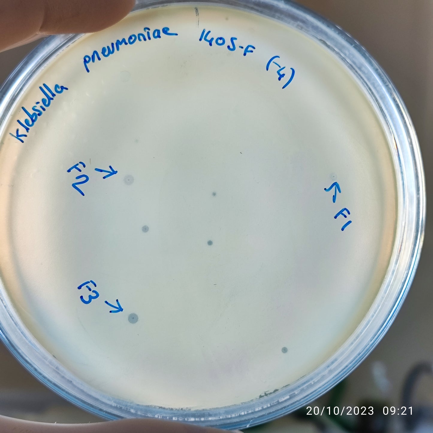 Klebsiella pneumoniae bacteriophage 181405F