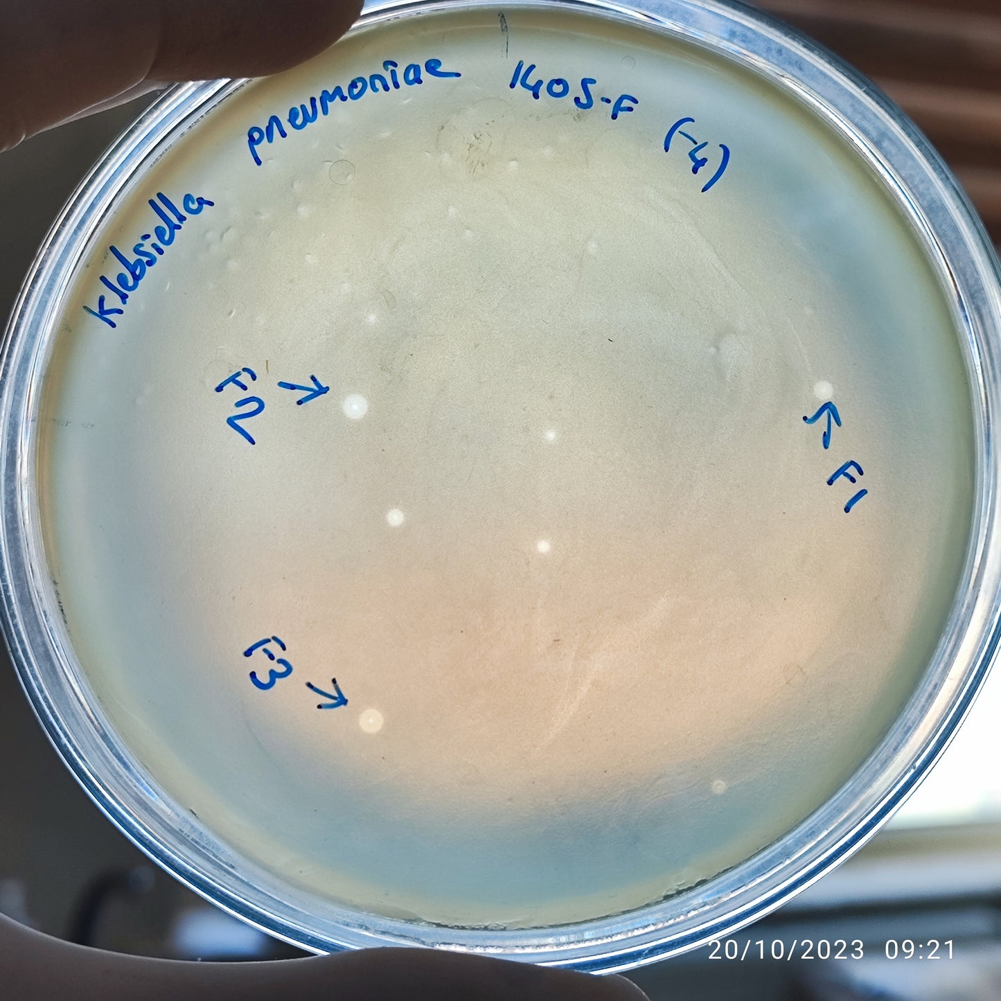 Klebsiella pneumoniae bacteriophage 181405F