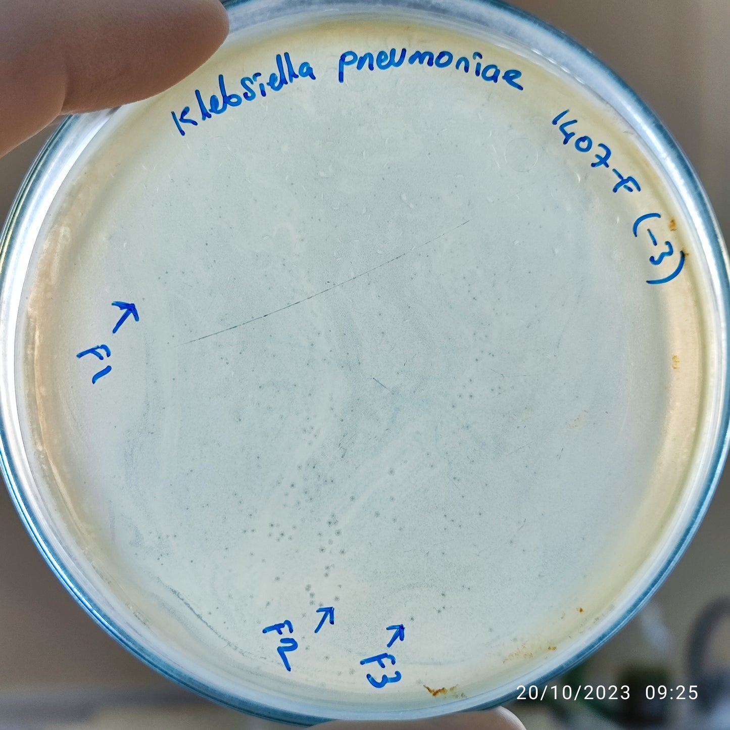 Klebsiella pneumoniae bacteriophage 181407F
