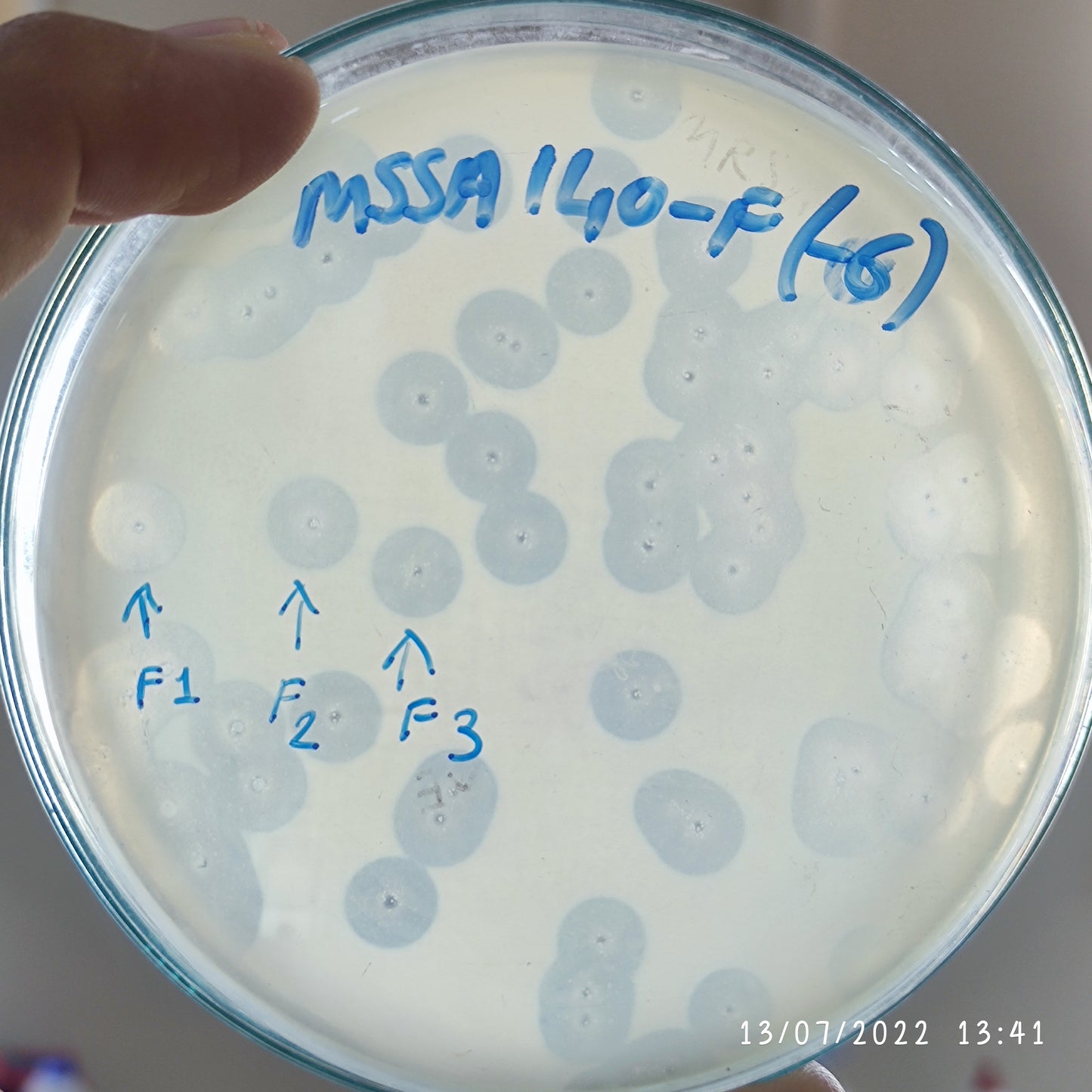 Staphylococcus aureus bacteriophage 152140F