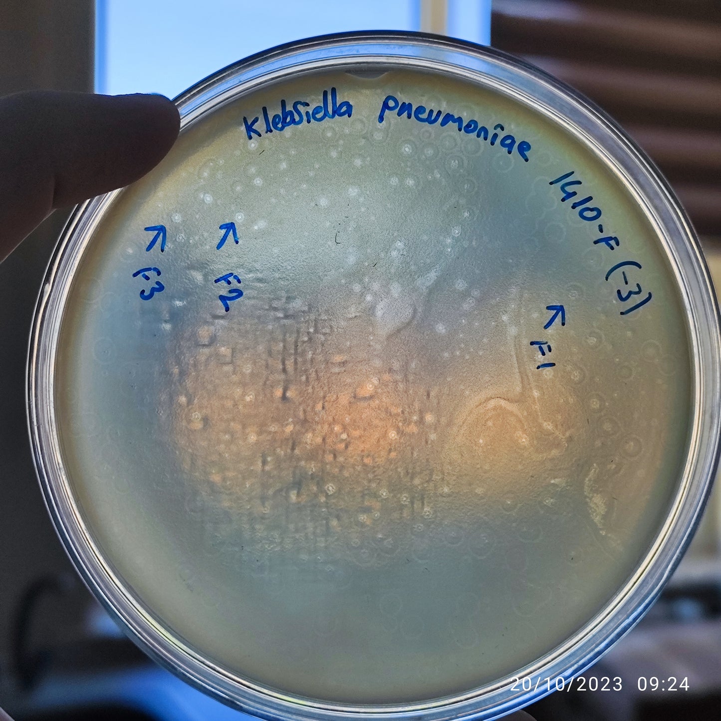 Klebsiella pneumoniae bacteriophage 181410F