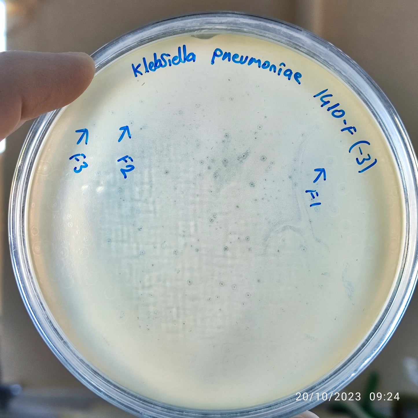 Klebsiella pneumoniae bacteriophage 181410F