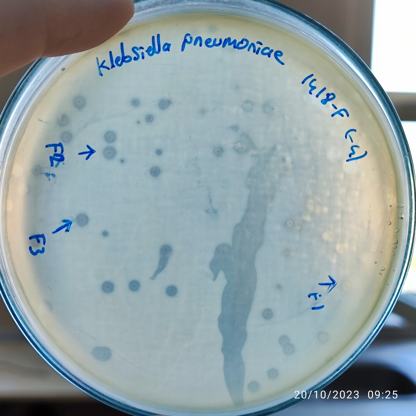Klebsiella pneumoniae bacteriophage 181418F