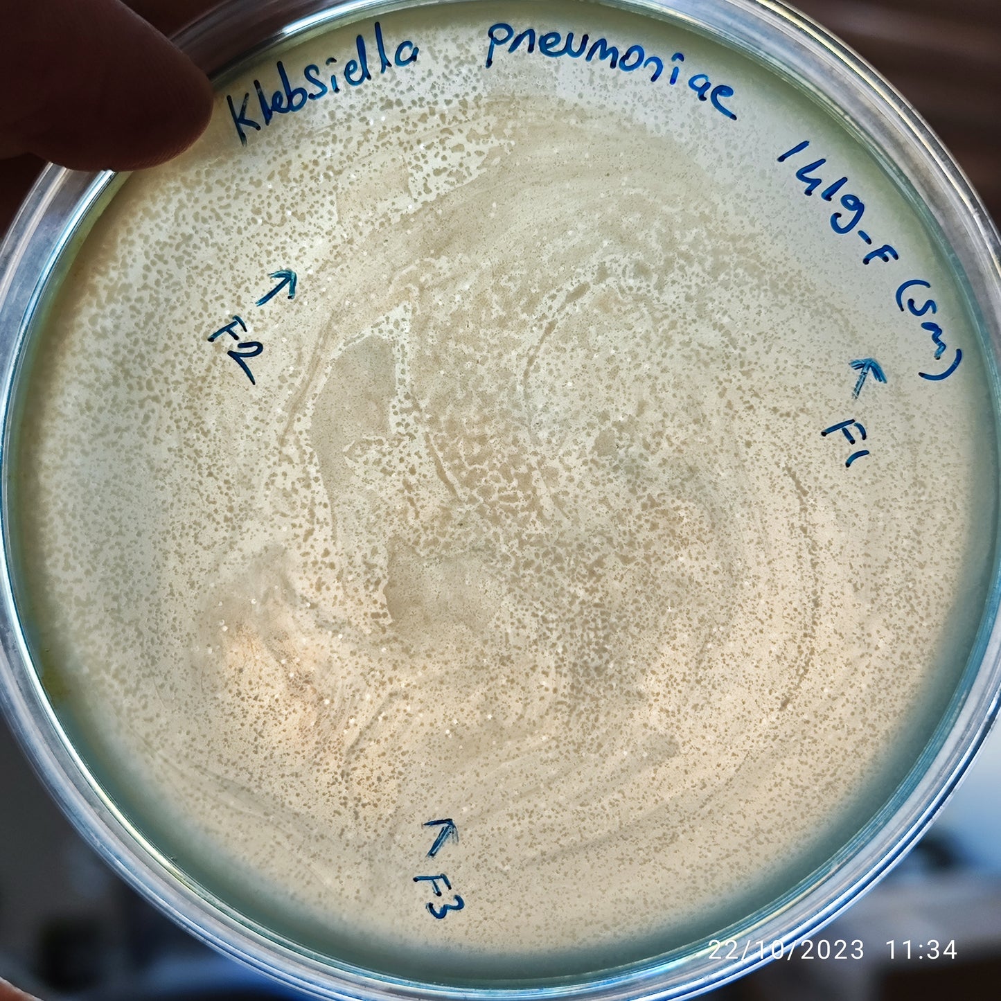 Klebsiella pneumoniae bacteriophage 181419F