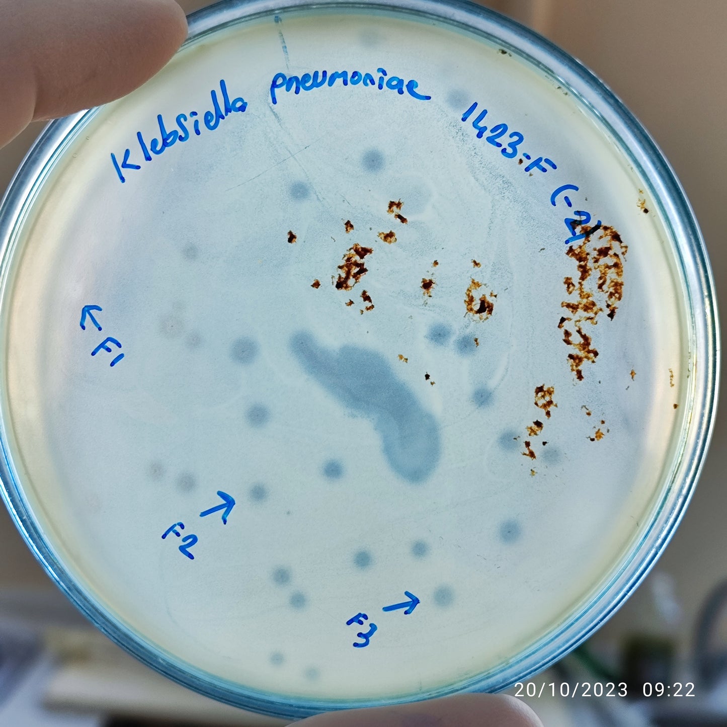 Klebsiella pneumoniae bacteriophage 181423F