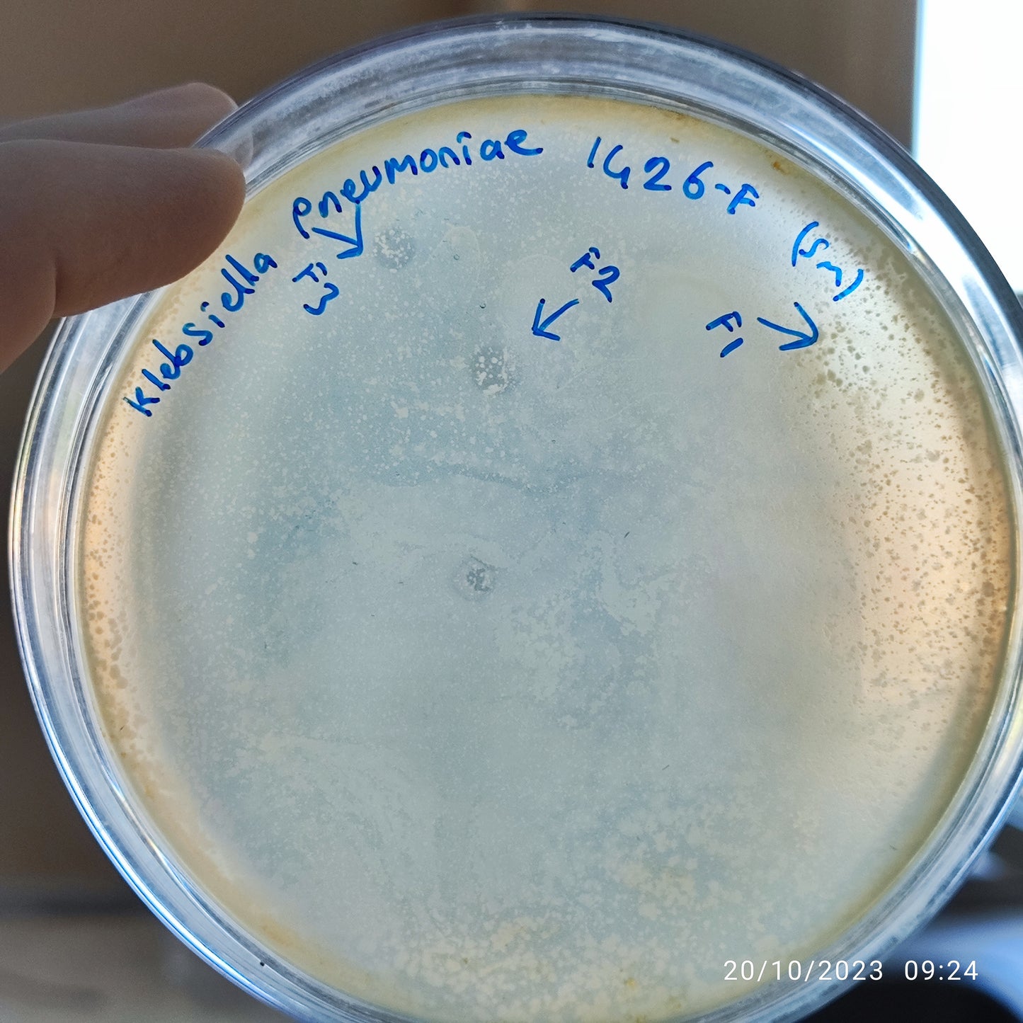 Klebsiella pneumoniae bacteriophage 181426F