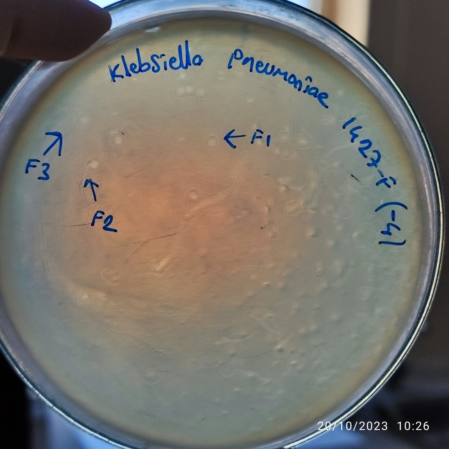 Klebsiella pneumoniae bacteriophage 181427F