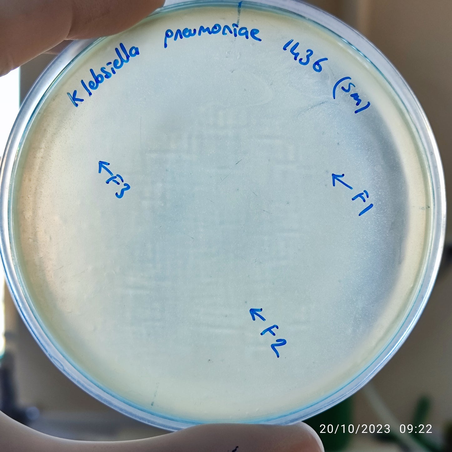 Klebsiella pneumoniae bacteriophage 181436F