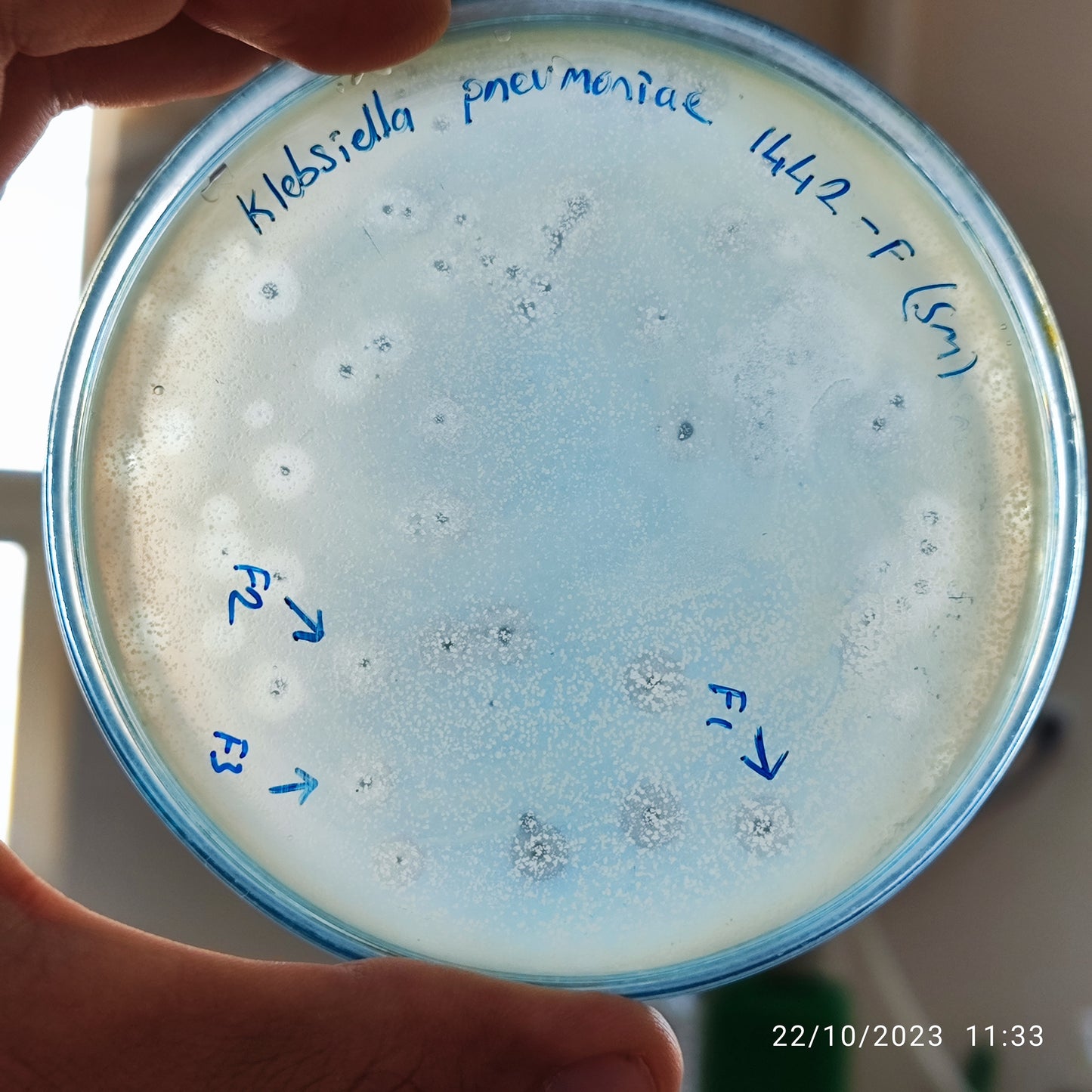 Klebsiella pneumoniae bacteriophage 181442F
