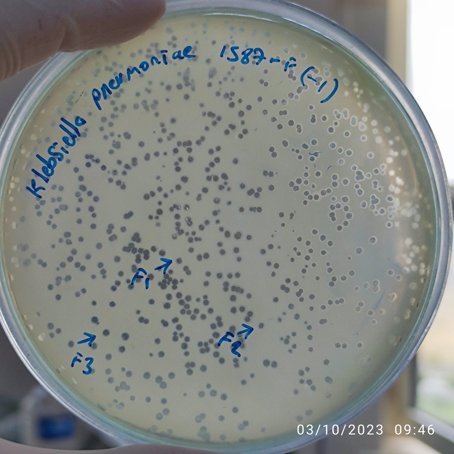 Klebsiella pneumoniae bacteriophage 181587F