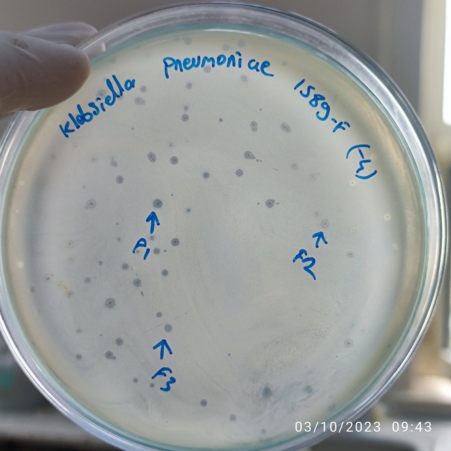 Klebsiella pneumoniae bacteriophage 181589F