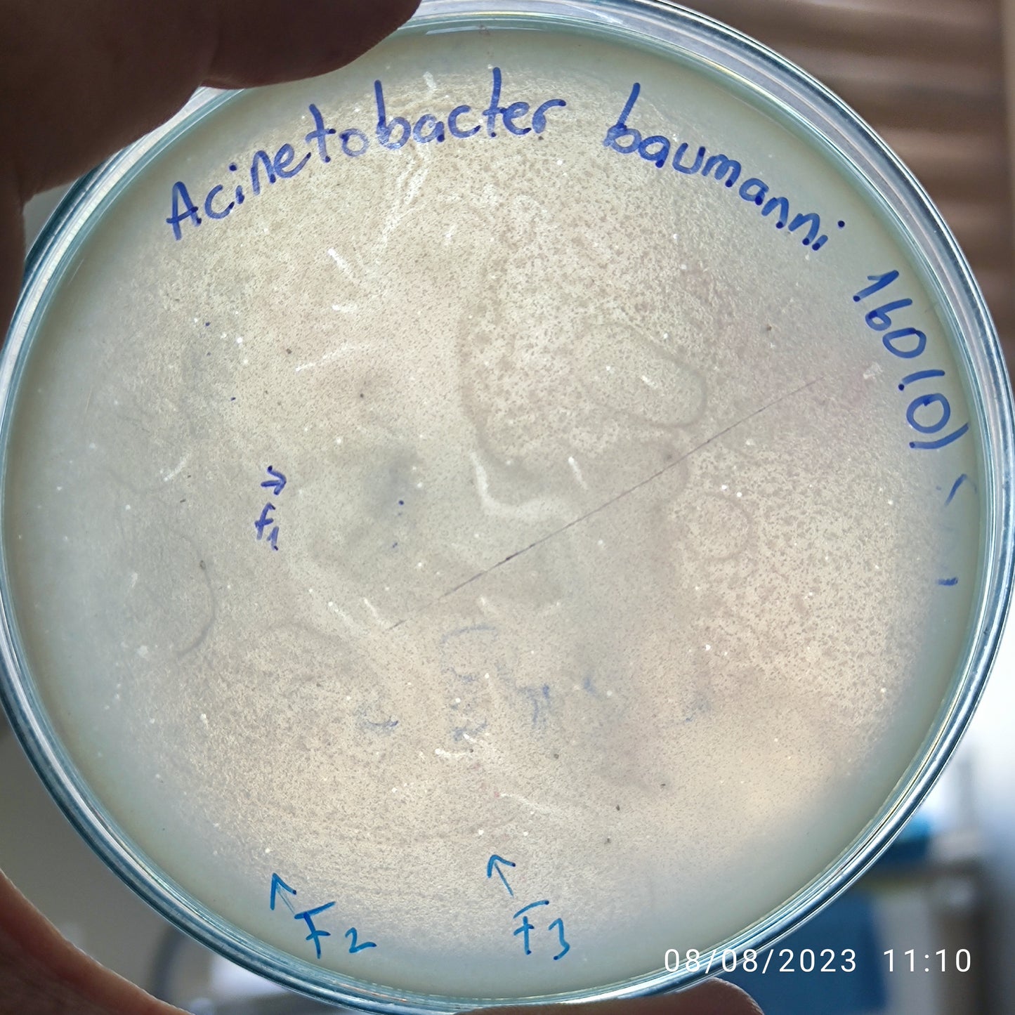 Acinetobacter baumannii bacteriophage 120160F