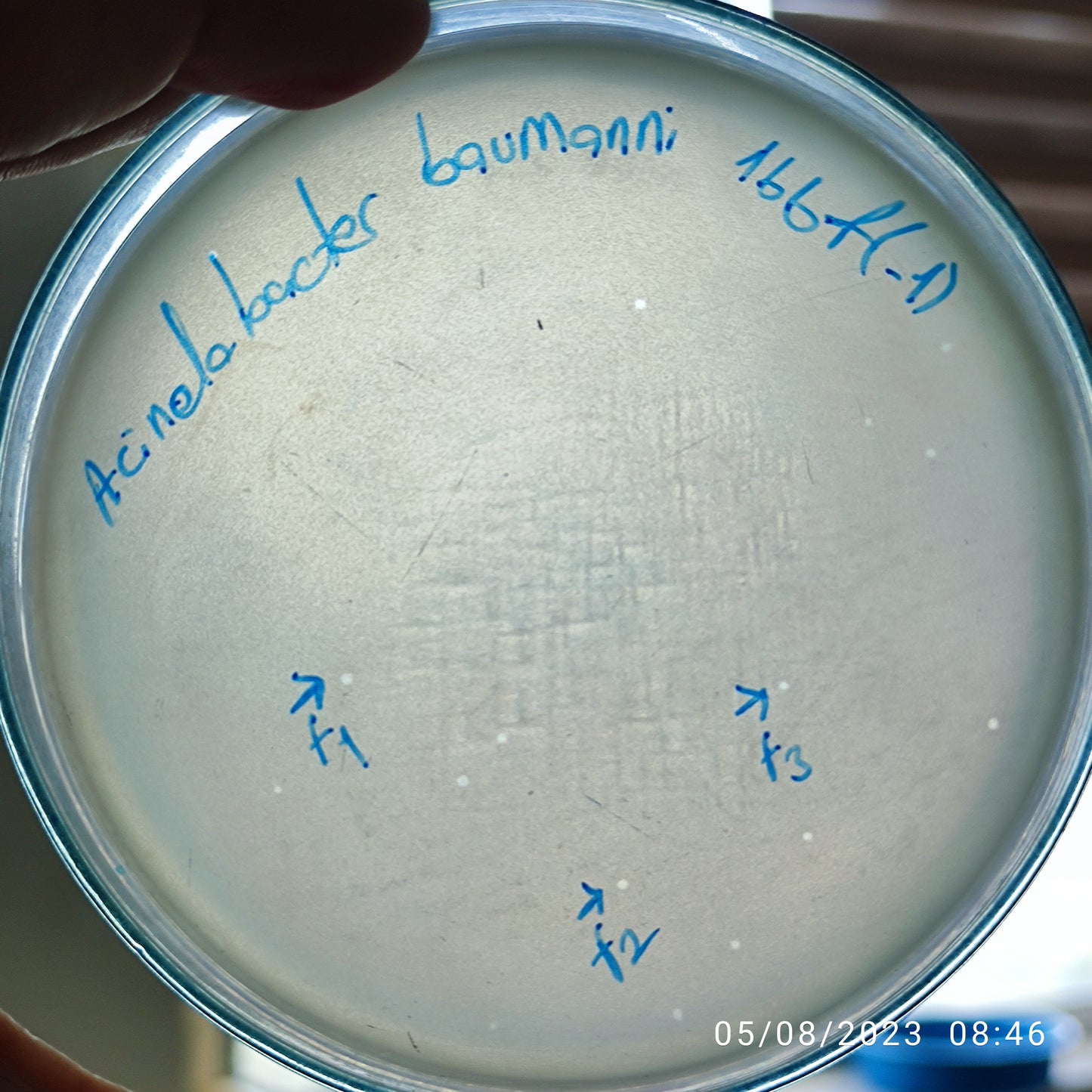 Acinetobacter baumannii bacteriophage 120166F