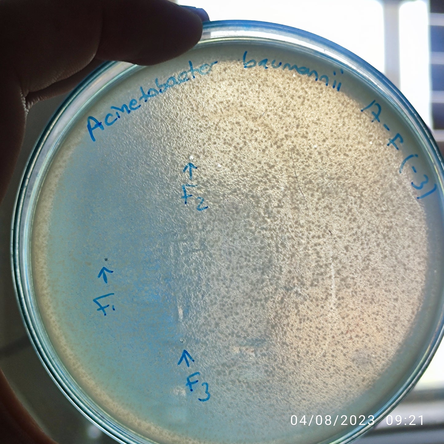Acinetobacter baumannii bacteriophage 120017F