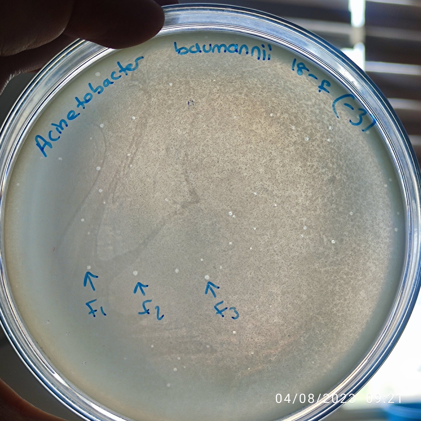 Acinetobacter baumannii bacteriophage 120018F