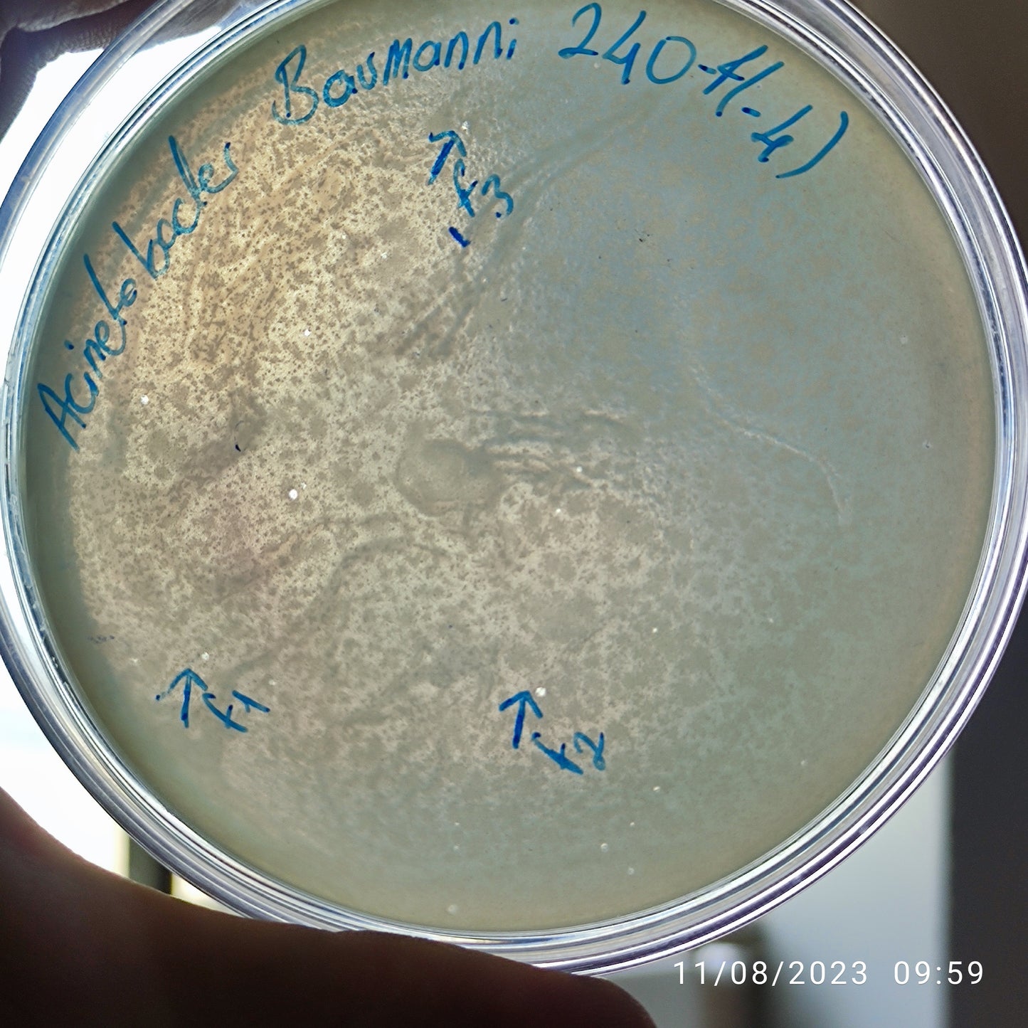Acinetobacter baumannii bacteriophage 120204F