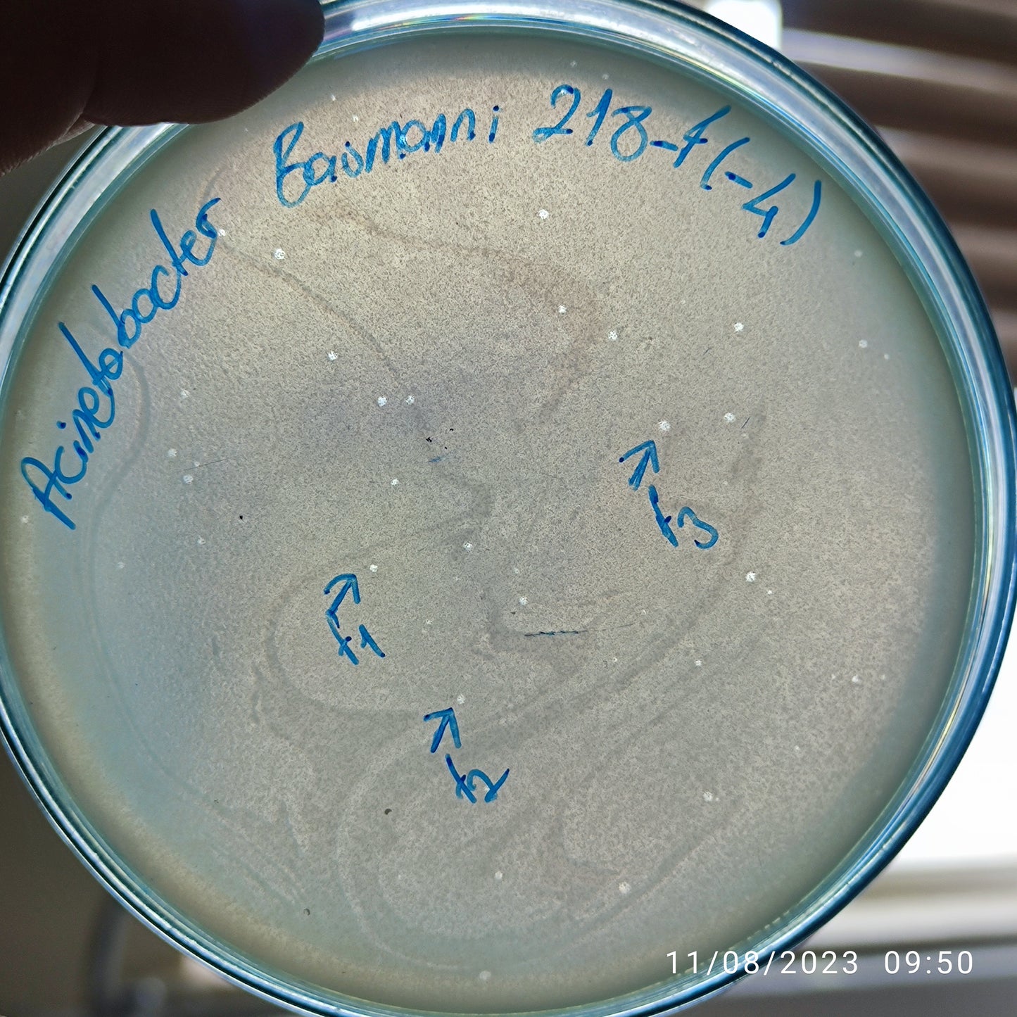 Acinetobacter baumannii bacteriophage 120218F