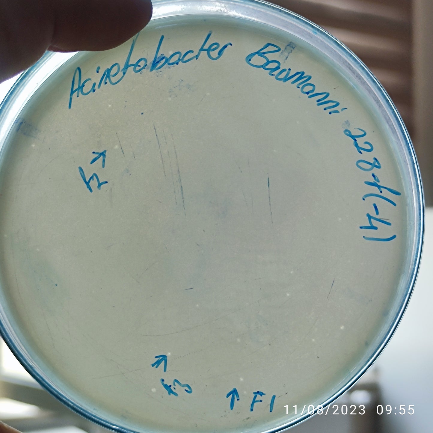 Acinetobacter baumannii bacteriophage 120228F