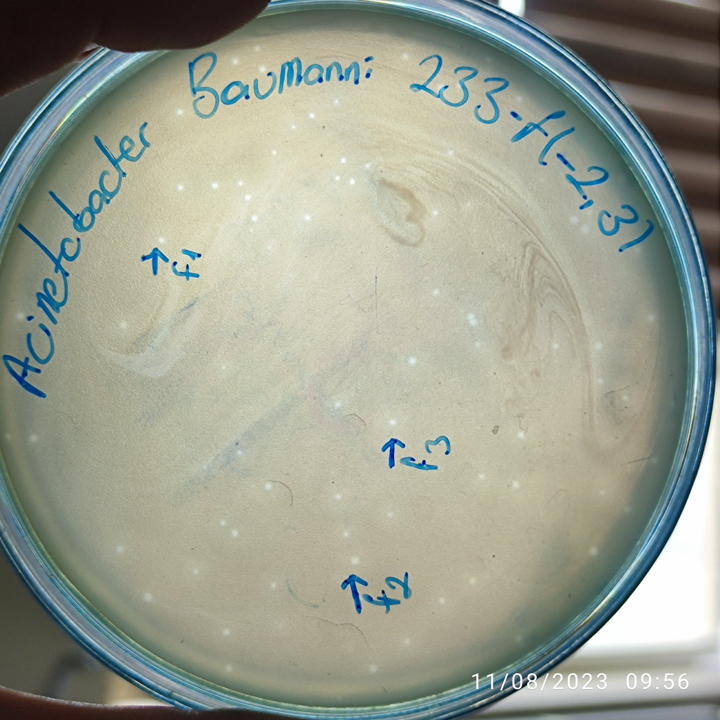 Acinetobacter baumannii bacteriophage 120233F