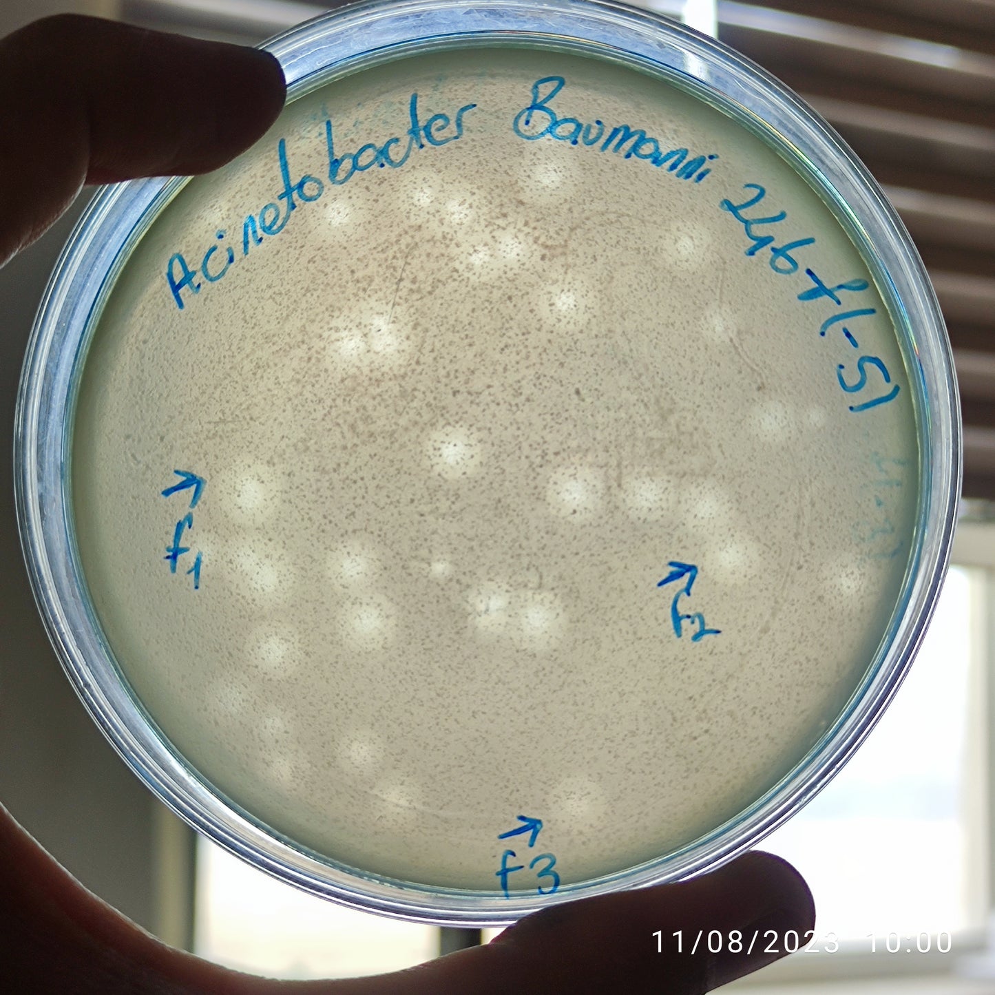Acinetobacter baumannii bacteriophage 120246F