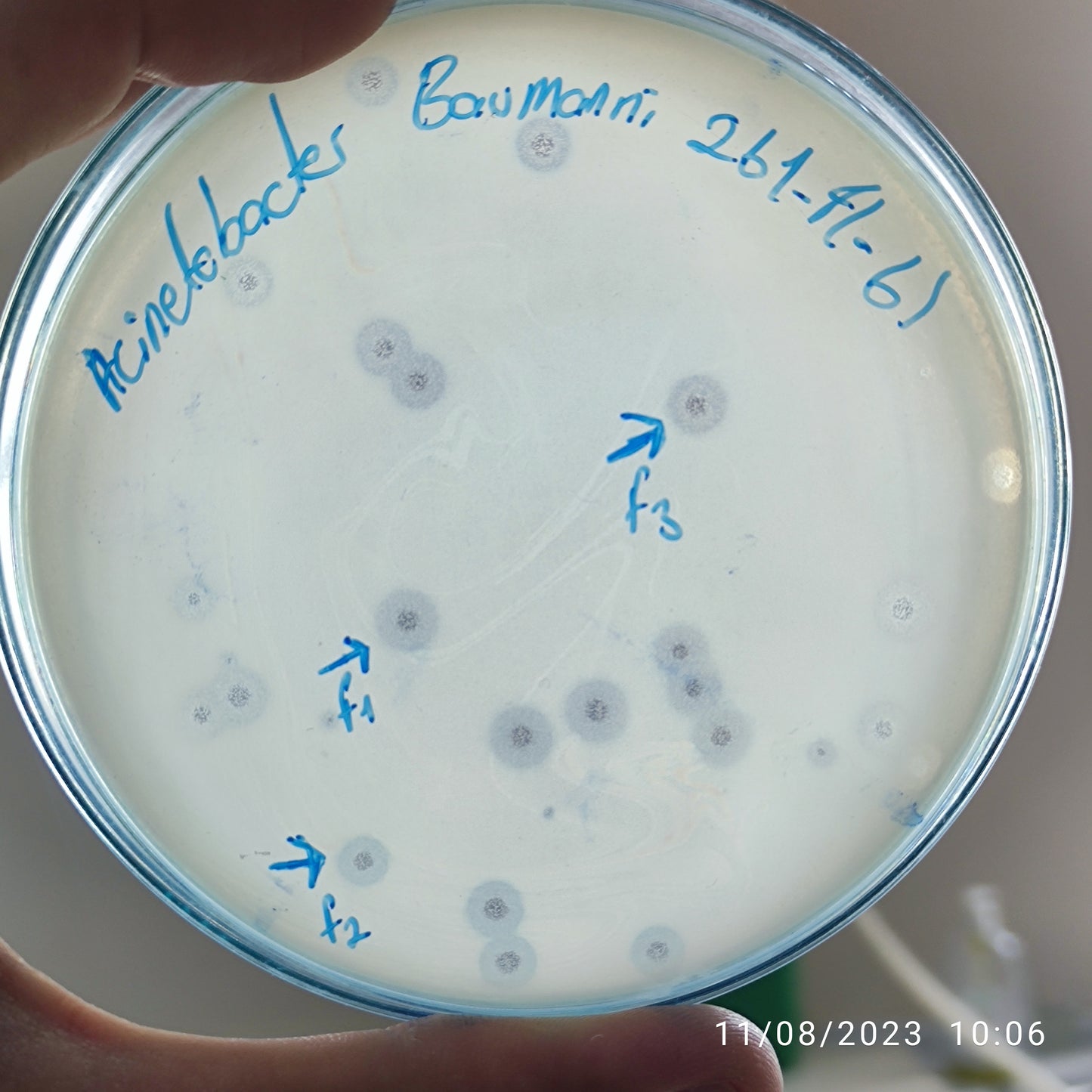 Acinetobacter baumannii bacteriophage 120261F