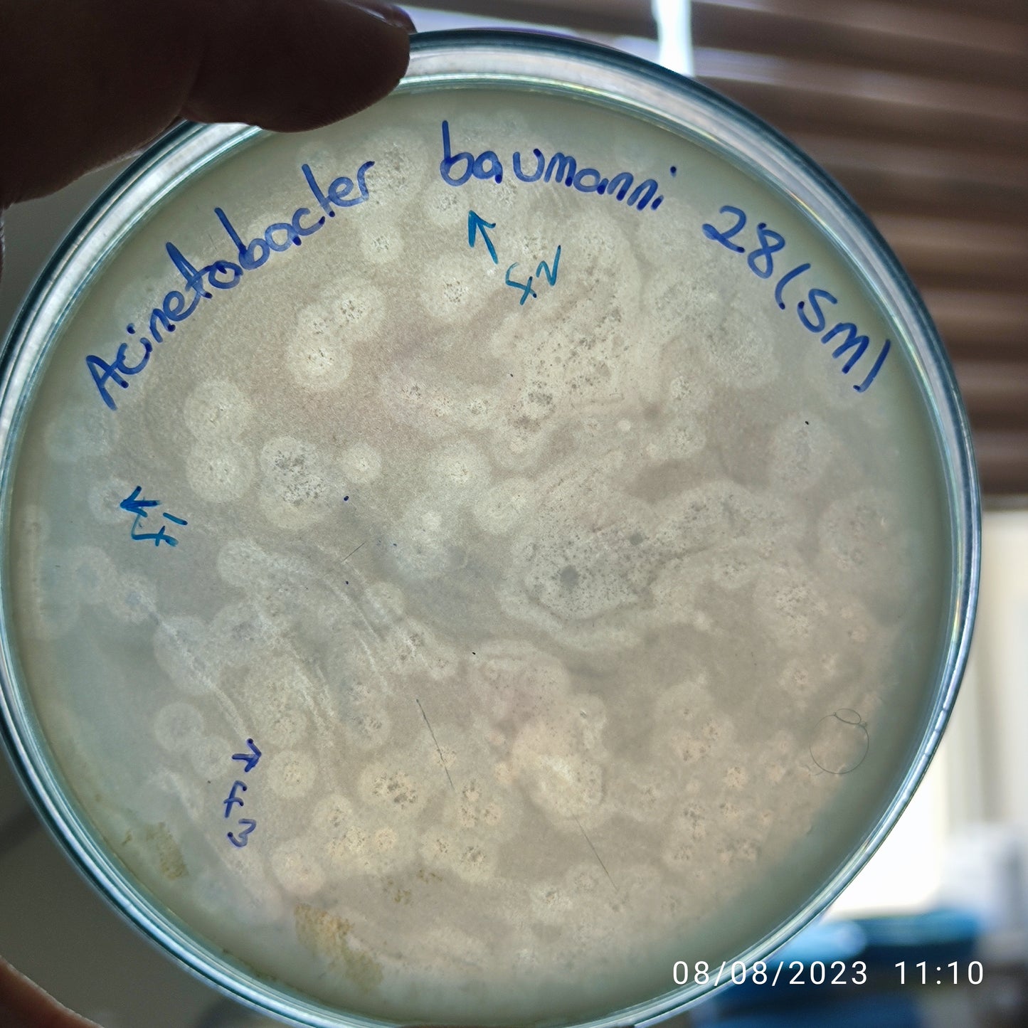 Acinetobacter baumannii bacteriophage 120028F