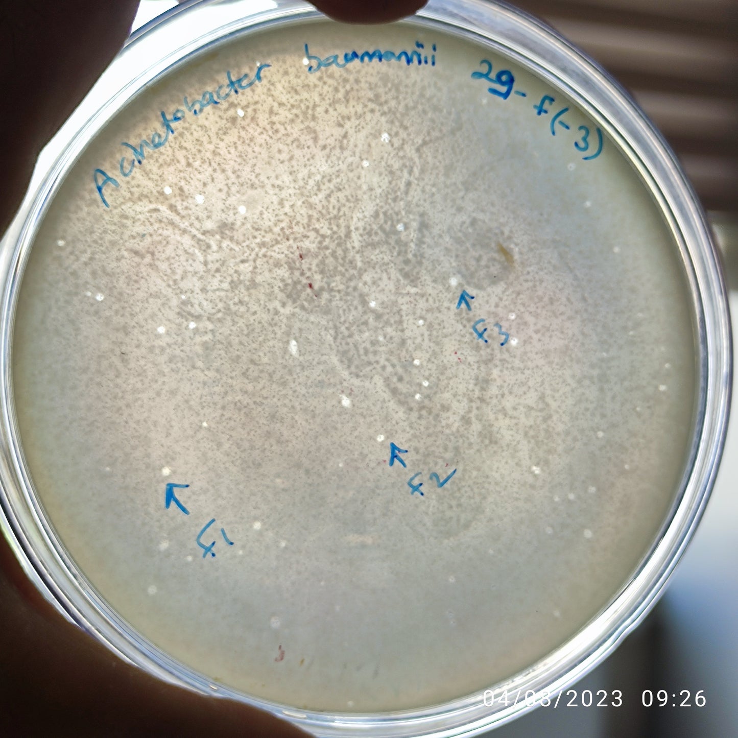 Acinetobacter baumannii bacteriophage 120029F