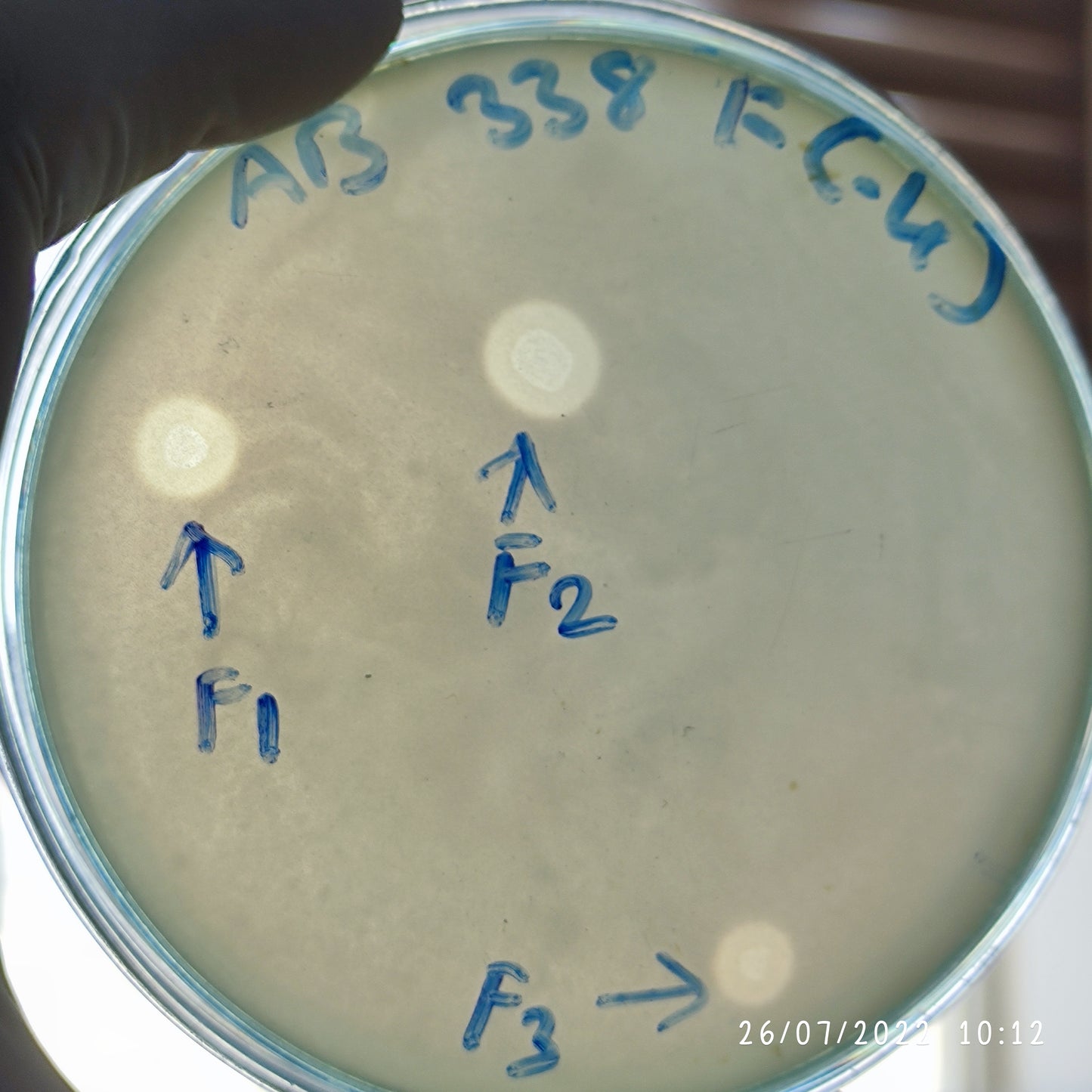 Acinetobacter baumannii bacteriophage 120338F