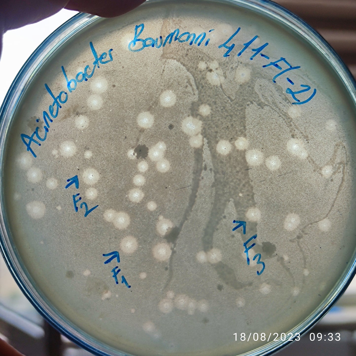 Acinetobacter baumannii bacteriophage 120411F