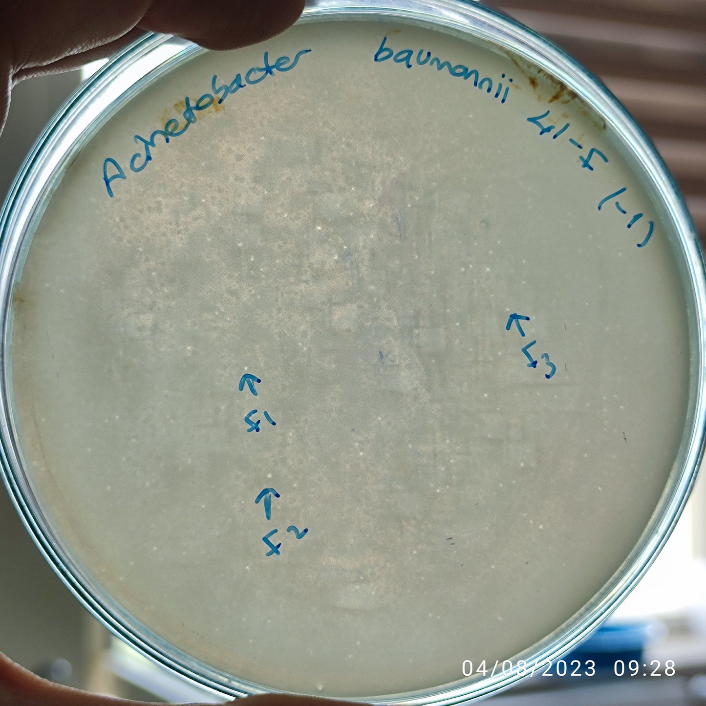 Acinetobacter baumannii bacteriophage 120041F