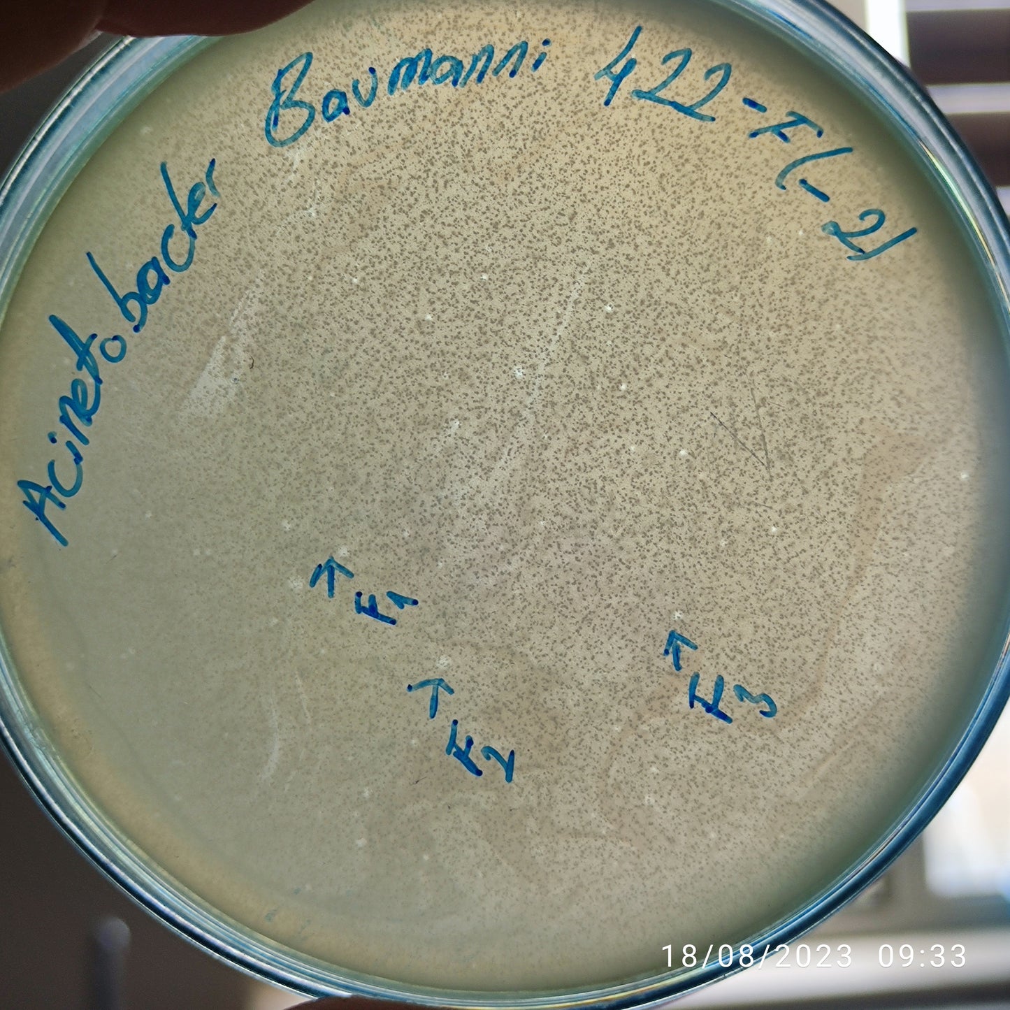 Acinetobacter baumannii bacteriophage 120422F