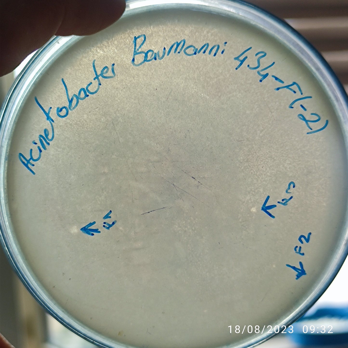 Acinetobacter baumannii bacteriophage 120434F