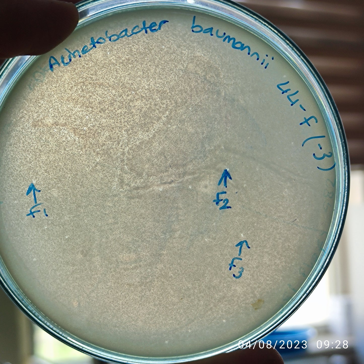 Acinetobacter baumannii bacteriophage 120044F