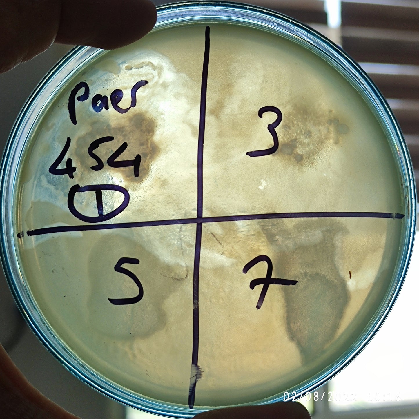 Pseudomonas aeruginosa bacteriophage 130454F