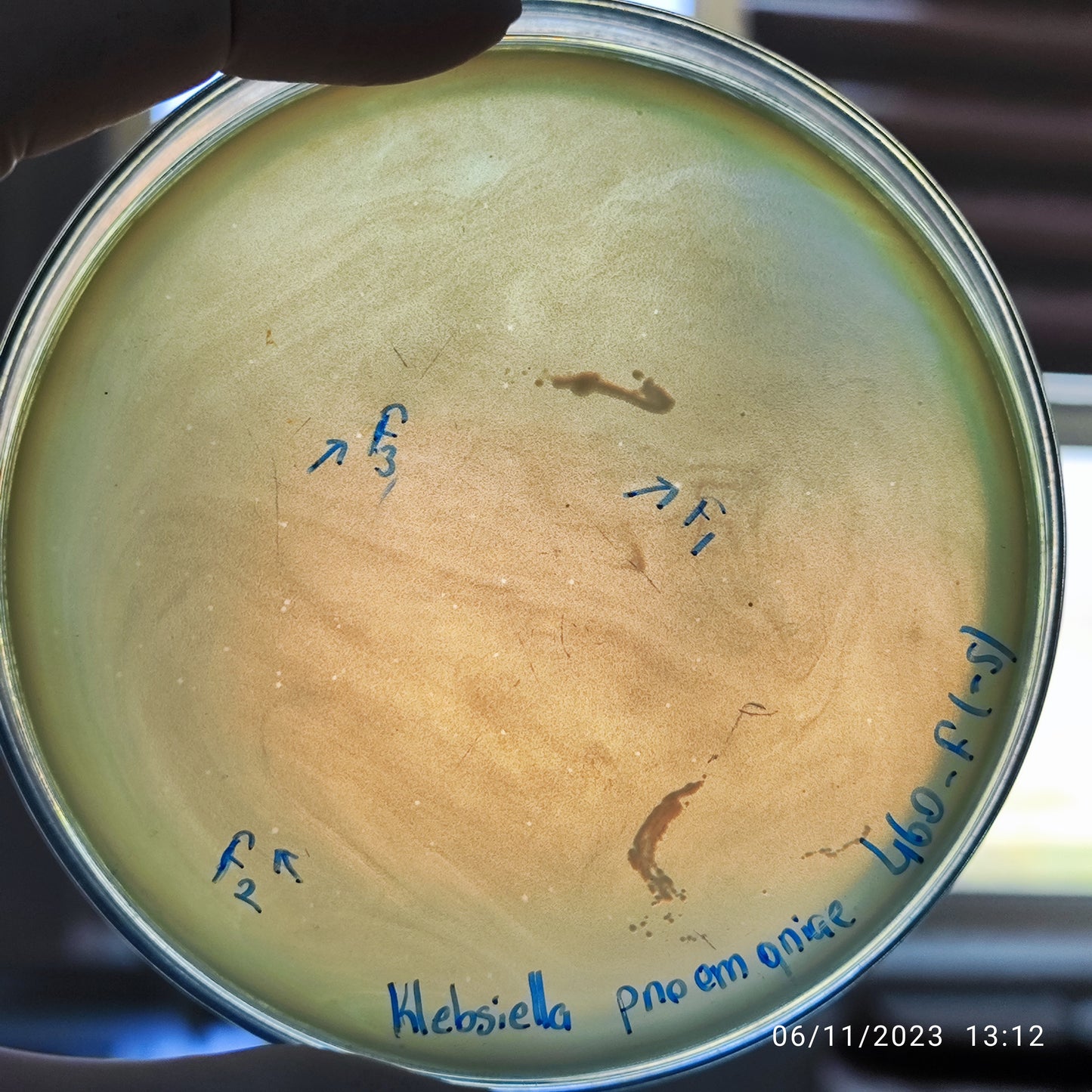 Klebsiella pneumoniae bacteriophage 180460F