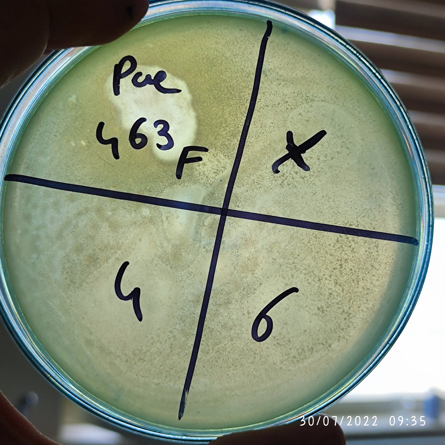 Pseudomonas aeruginosa bacteriophage 130463F