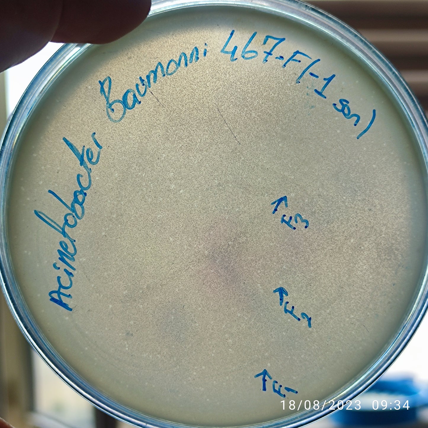 Acinetobacter baumannii bacteriophage 120467F