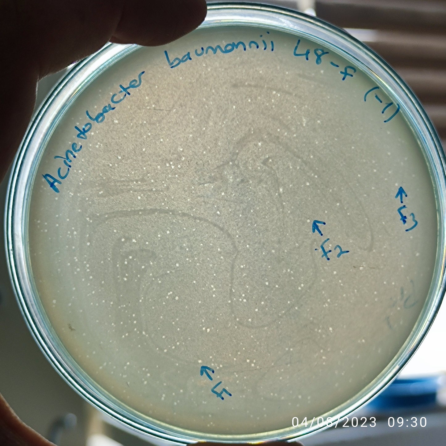 Acinetobacter baumannii bacteriophage 120048F