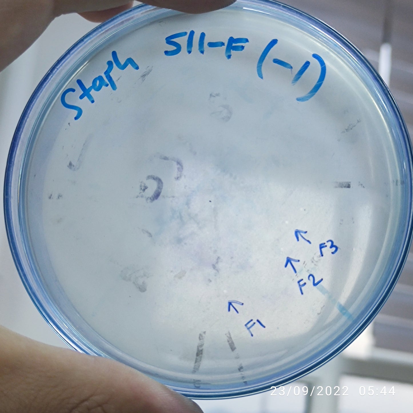 Staphylococcus aureus bacteriophage 152511F
