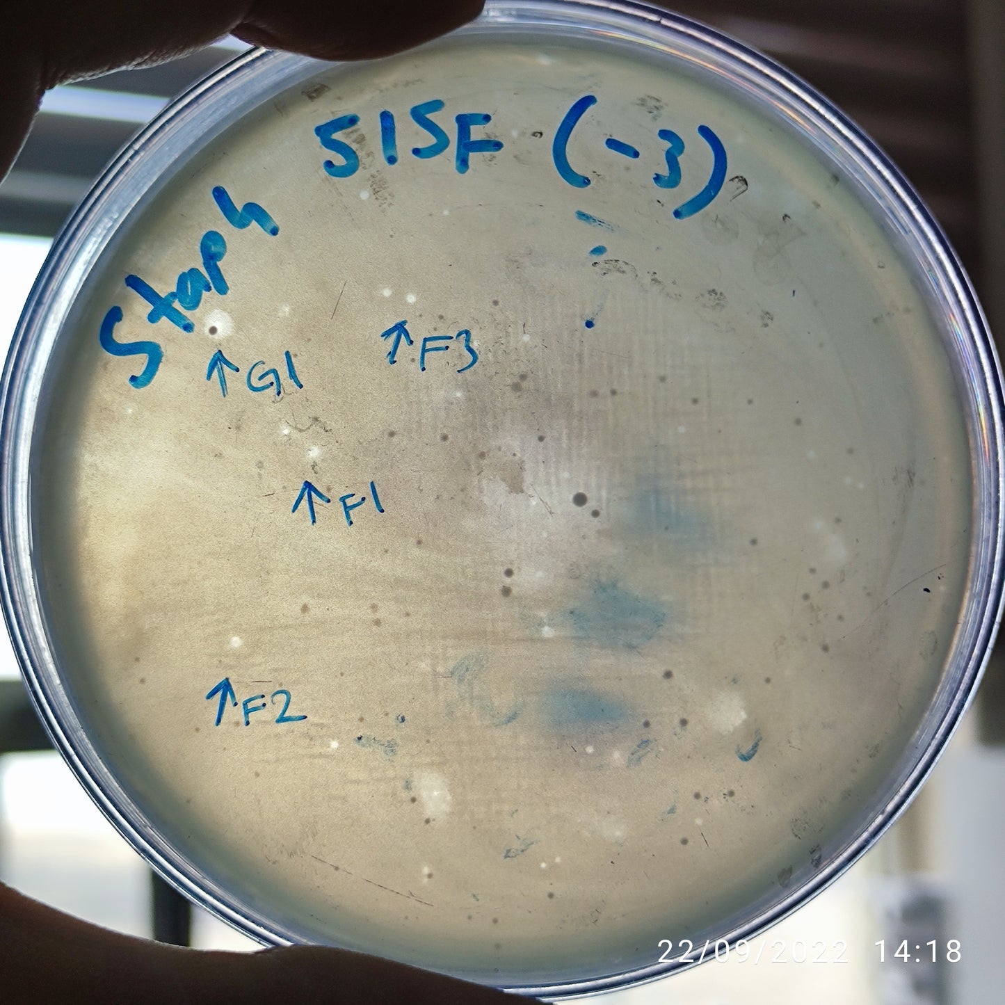 Staphylococcus aureus bacteriophage 152515G