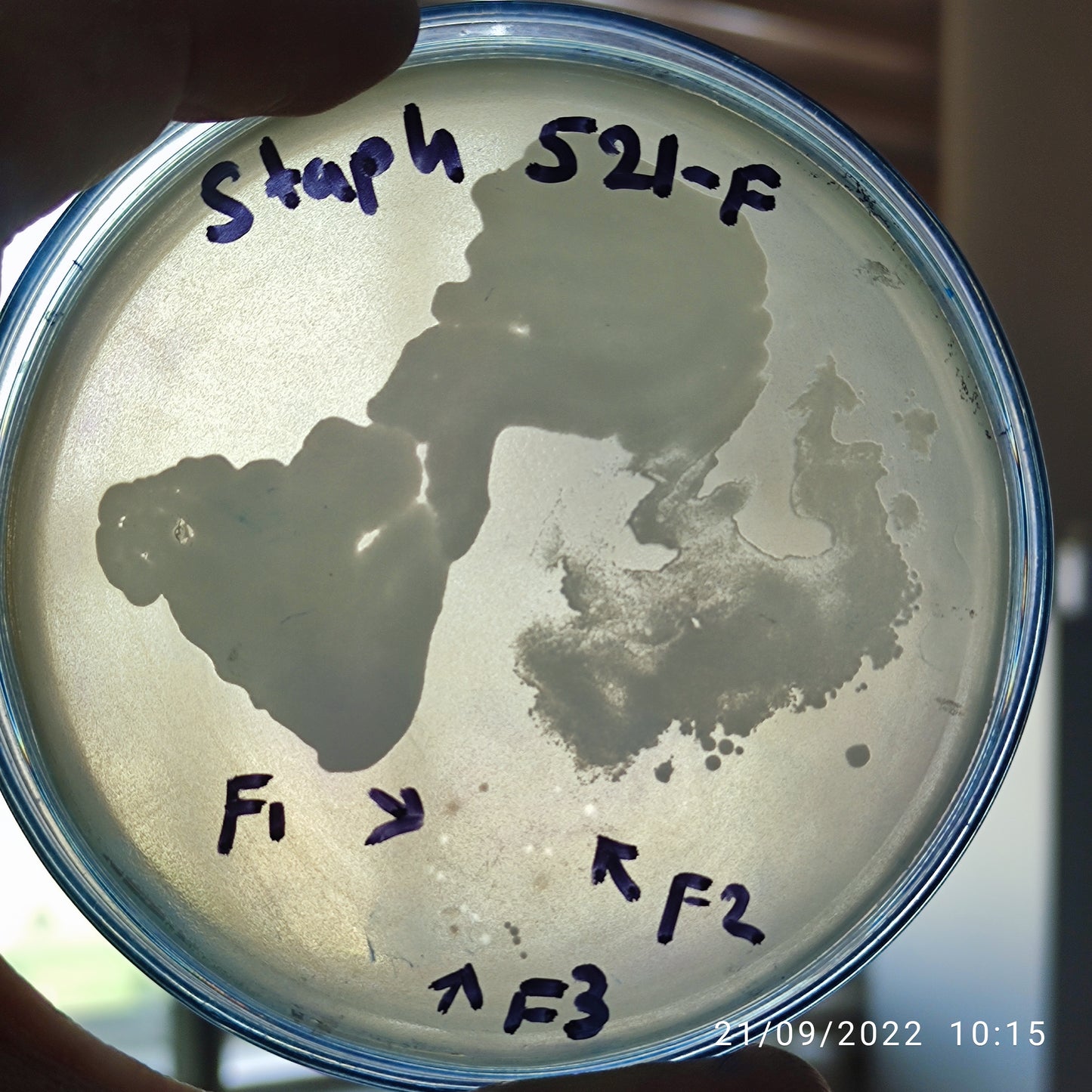 Staphylococcus aureus bacteriophage 152521F