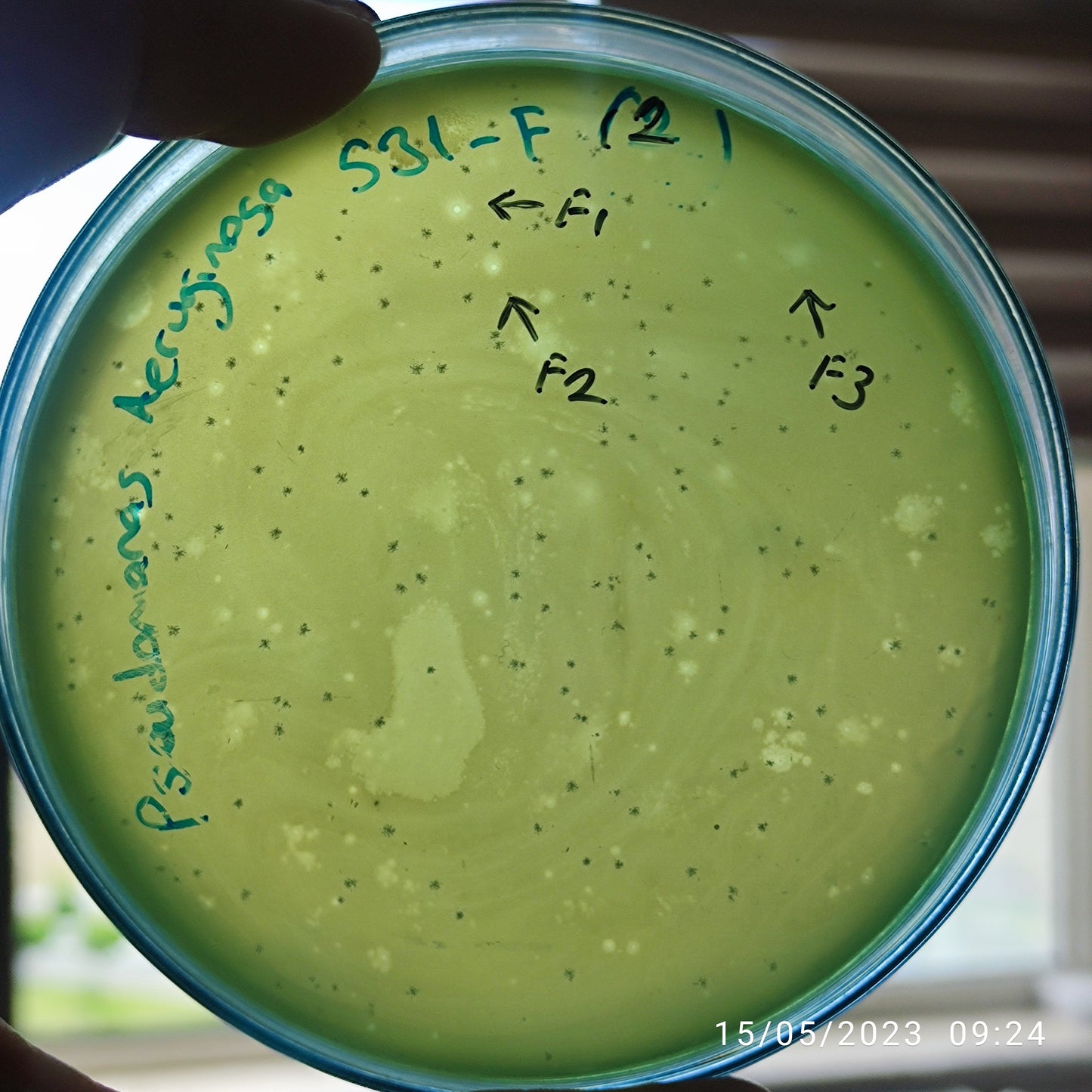 Pseudomonas aeruginosa bacteriophage 130531F