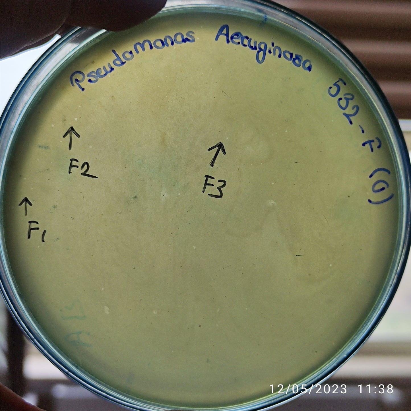 Pseudomonas aeruginosa bacteriophage 130532F