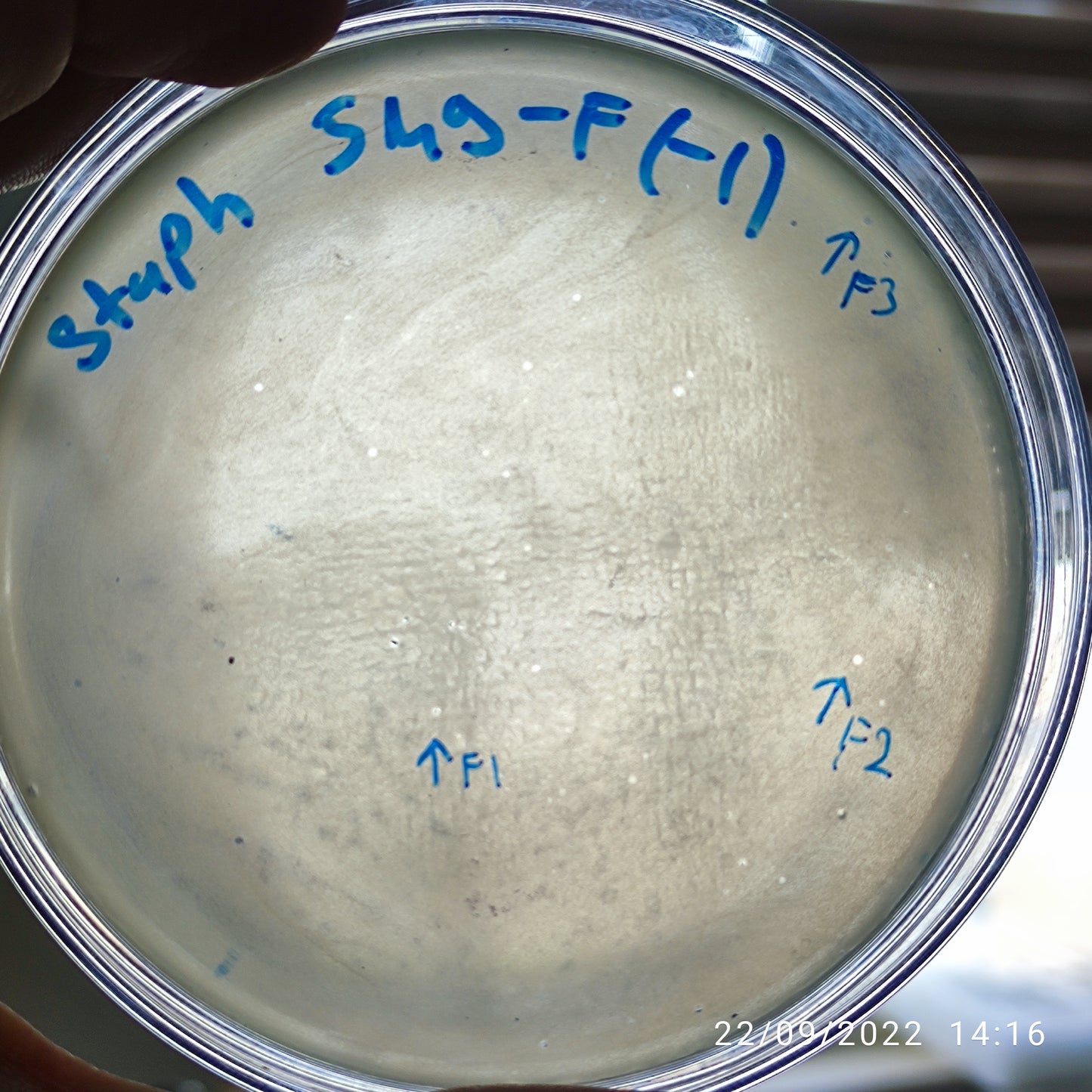 Staphylococcus aureus bacteriophage 152549F
